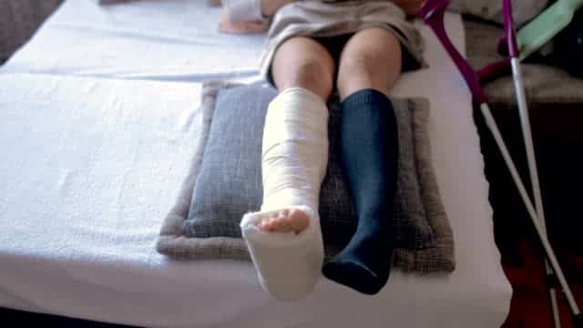 Disabled woman with broken leg and plaster foot at home